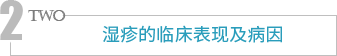 湿疹的临床表现及病因